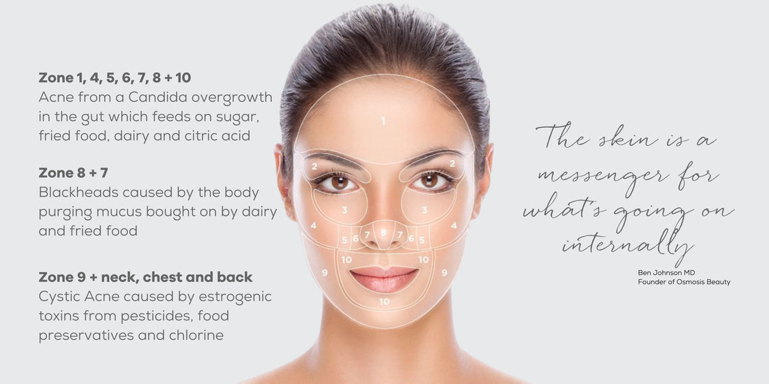 HOW TO GET RID OF PIMPLES