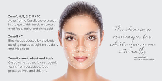 HOW TO GET RID OF PIMPLES